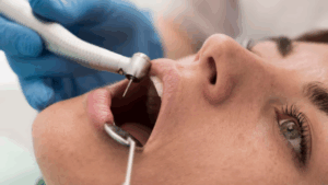 Looking for dental implants in Nizampura? Visit Tooth Care Dental Clinic for permanent, stable tooth replacement solutions with expert care and precise diagnostics.